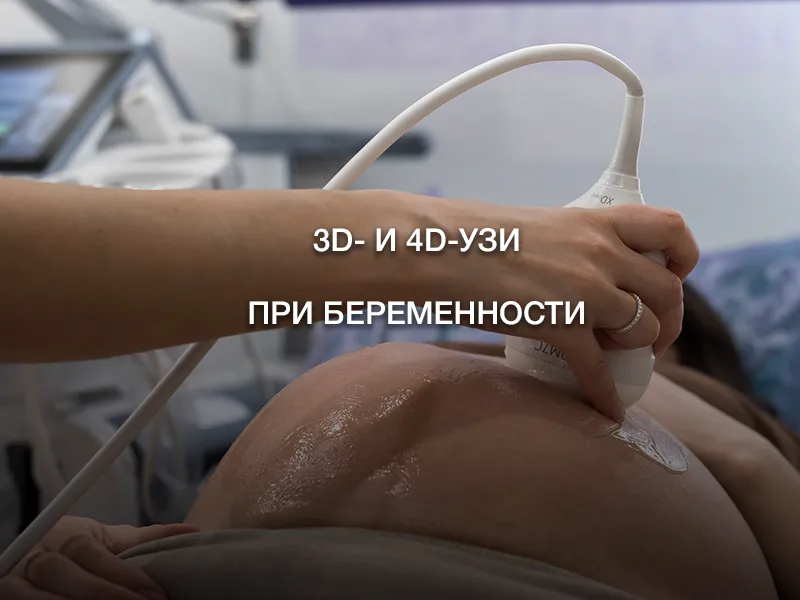 3D- и 4D-УЗИ при беременности 3D- и 4D-УЗИ при беременности