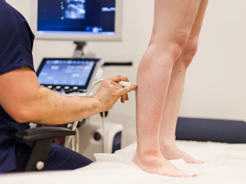 Дуплексное сканирование вен нижних конечностей Дуплексное сканирование вен нижних конечностей