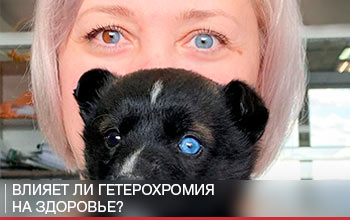 Влияет ли гетерохромия на здоровье? Влияет ли гетерохромия на здоровье?