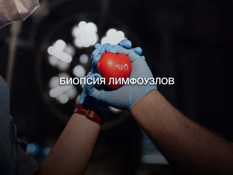 Биопсия лимфоузлов Биопсия лимфоузлов