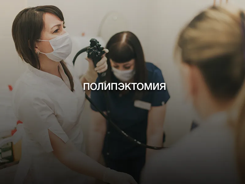 Полипэктомия Полипэктомия