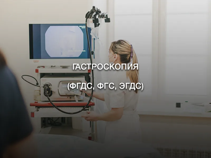 Гастроскопия (ФГДС, ФГС, ЭГДС) Гастроскопия (ФГДС, ФГС, ЭГДС)