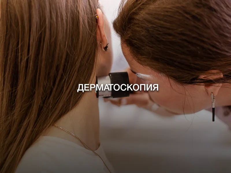 Дерматоскопия