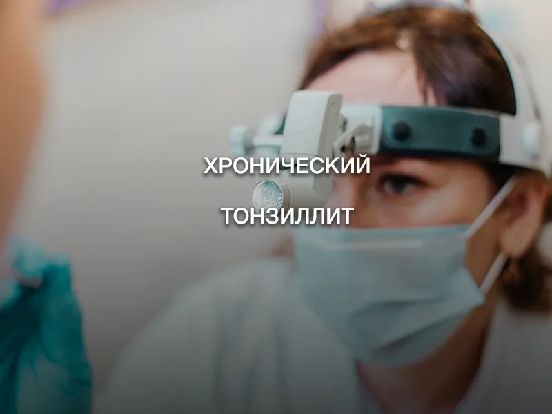 Хронический тонзиллит Хронический тонзиллит