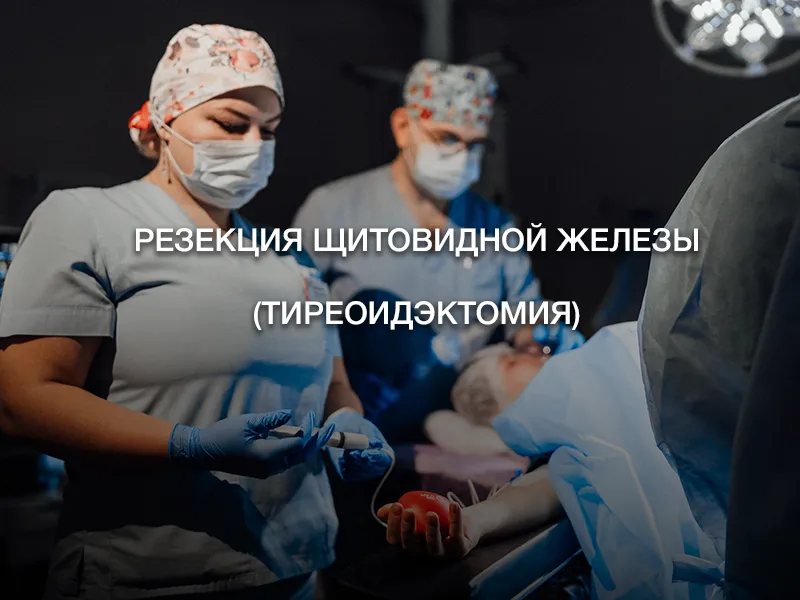 Резекция щитовидной железы (тиреоидэктомия) Резекция щитовидной железы (тиреоидэктомия)