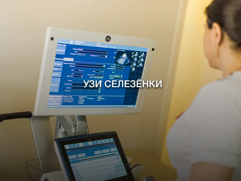 УЗИ селезёнки УЗИ селезёнки