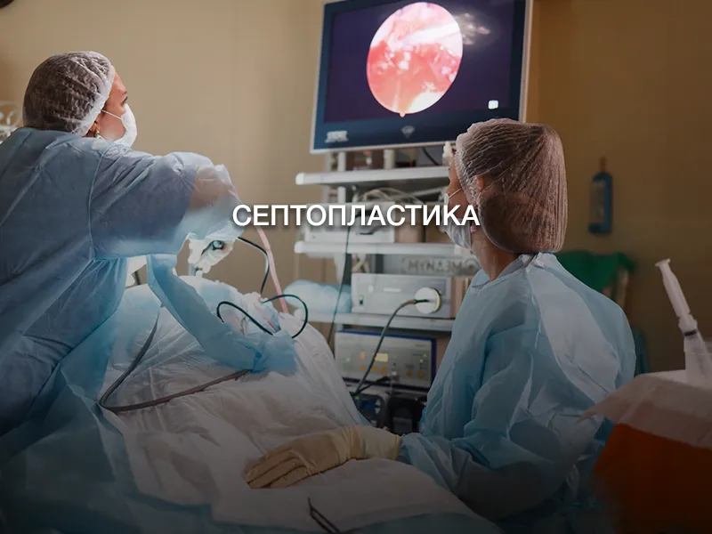 Септопластика Септопластика