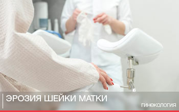 Эрозия шейки матки Эрозия шейки матки