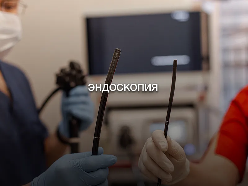 Эндоскопия Эндоскопия