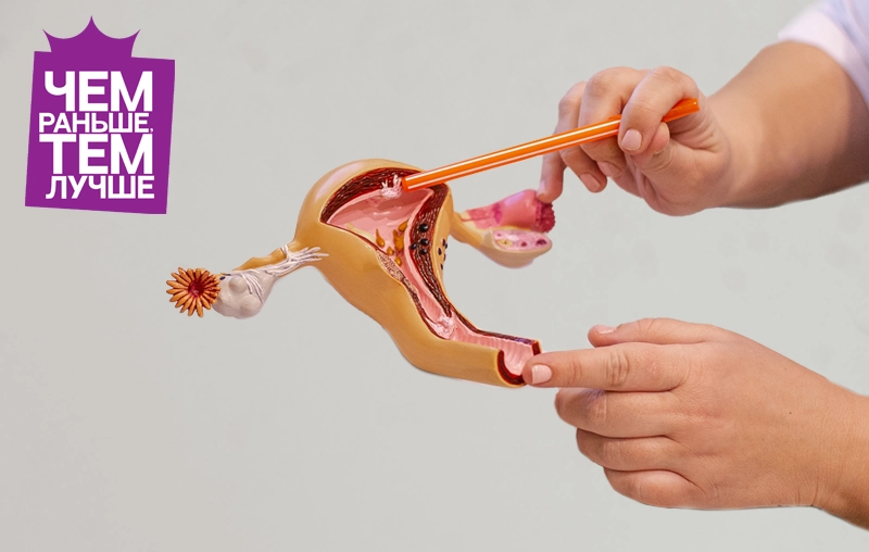 Рак шейки матки. Что важно знать?