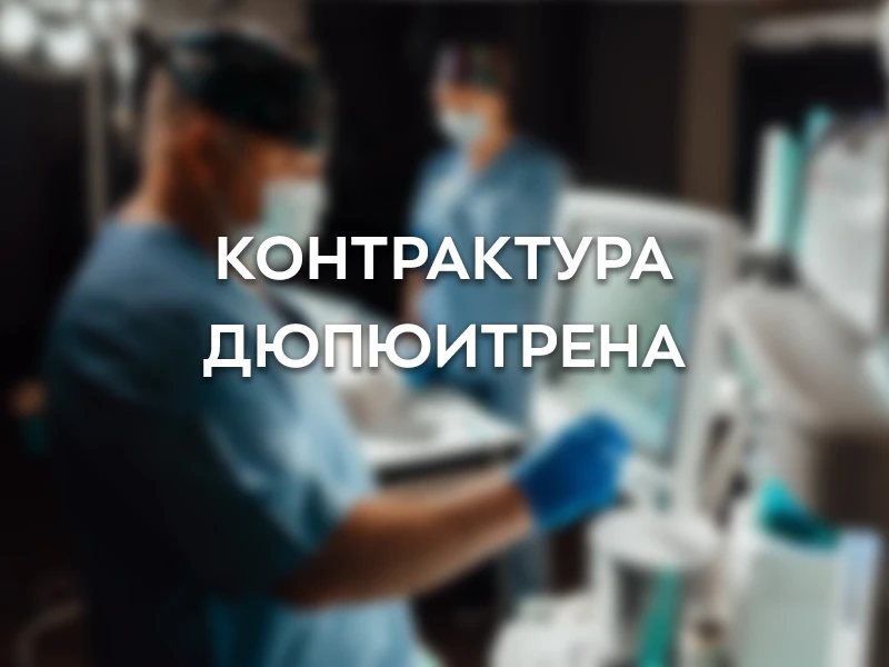 Контрактура Дюпюитрена Контрактура Дюпюитрена