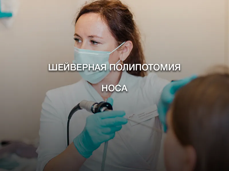 Шейверная полипотомия носа Шейверная полипотомия носа