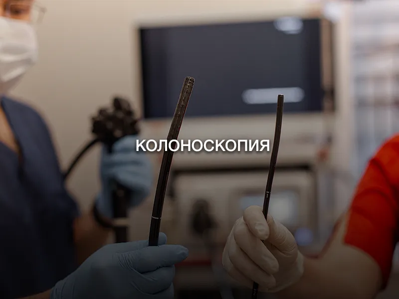 Колоноскопия Колоноскопия