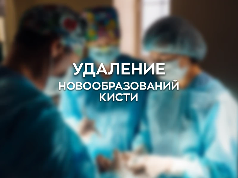 Удаление новообразований кисти