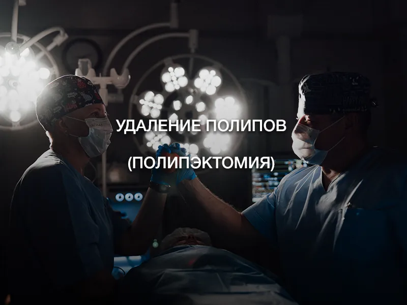 Удаление полипов (полипэктомия) Удаление полипов (полипэктомия)